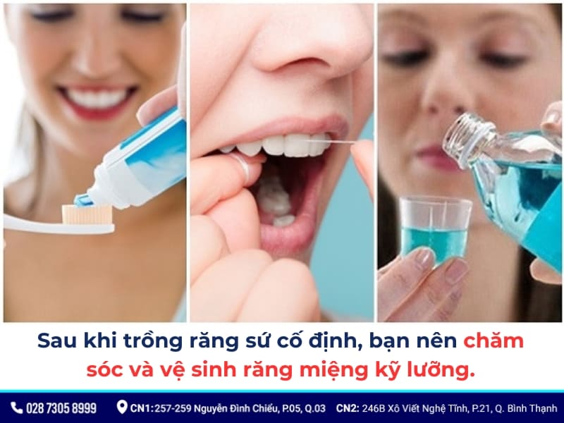 trồng răng sứ cố định