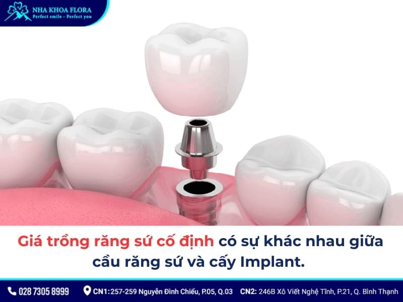 trồng răng sứ cố định