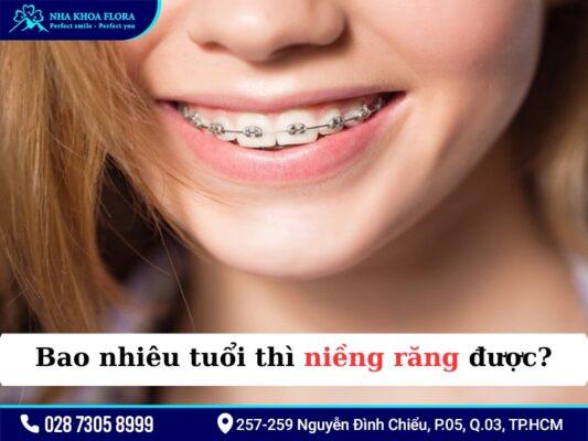 20 tuổi niềng răng bao lâu - ảnh 1
