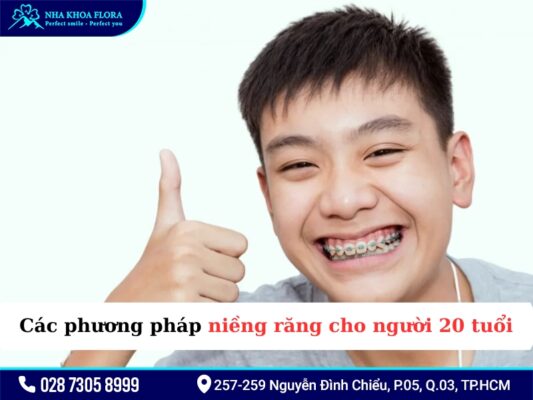 20 tuổi niềng răng bao lâu - ảnh 3