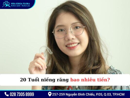 20 tuổi niềng răng bao lâu - ảnh 4