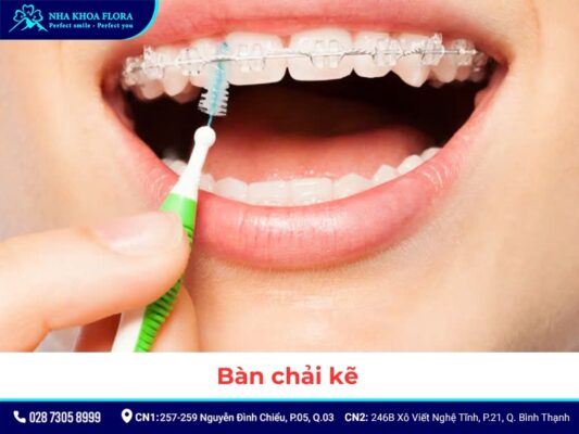 Bàn chải cho người niềng răng - ảnh 3 Bàn chải cho người niềng răng - ảnh 3