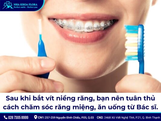 Bắt vít niềng răng - ảnh 6