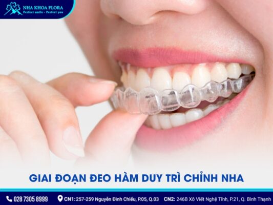 các giai đoạn niềng răng - ảnh 3