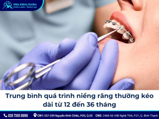 các giai đoạn niềng răng - ảnh 6