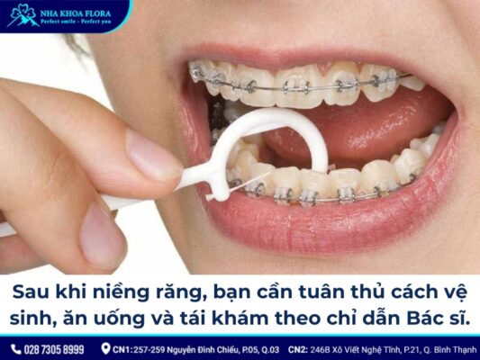 các giai đoạn niềng răng - ảnh 7
