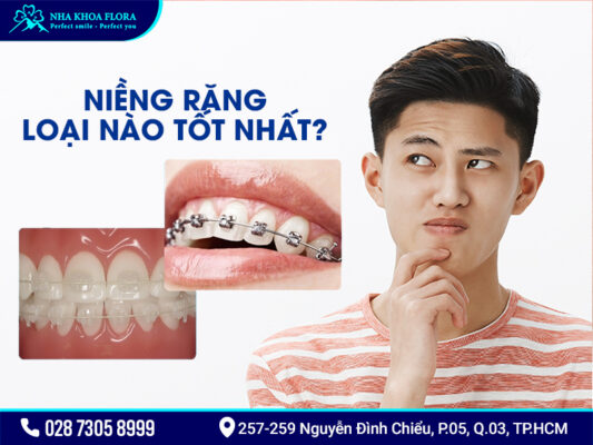 Các kiểu niềng răng - ảnh 4