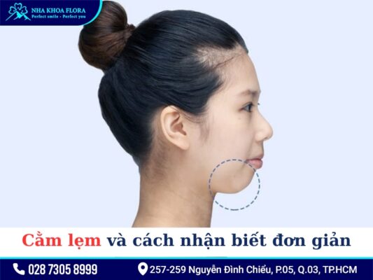 Cằm lẹm niềng răng - ảnh 1
