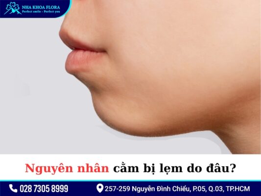Cằm lẹm niềng răng - ảnh 2