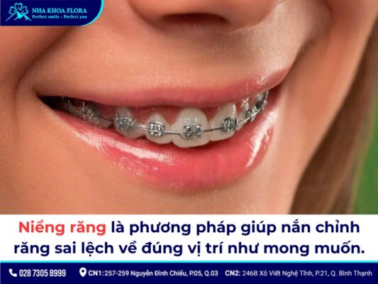 Có nên niềng răng không - ảnh 1