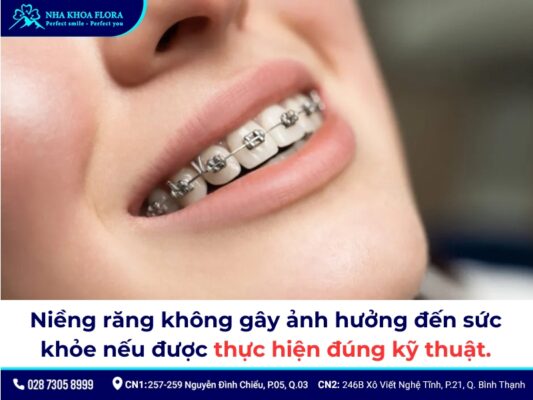 Có nên niềng răng không - ảnh 4