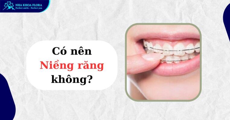 Có nên niềng răng không