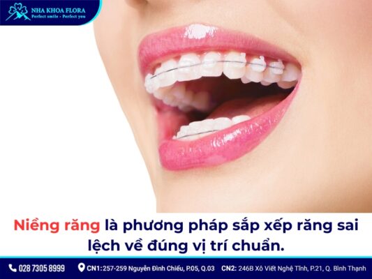 độ tuổi niềng răng - ảnh 1