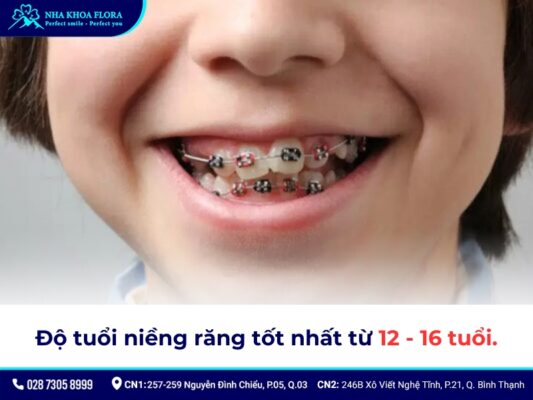 độ tuổi niềng răng - ảnh 2