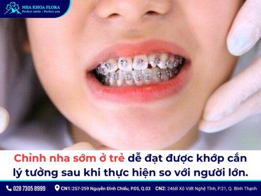 độ tuổi niềng răng - ảnh 4