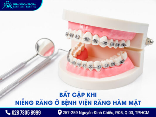 Giá niềng răng ở bệnh viện Răng hàm mặt - ảnh 3