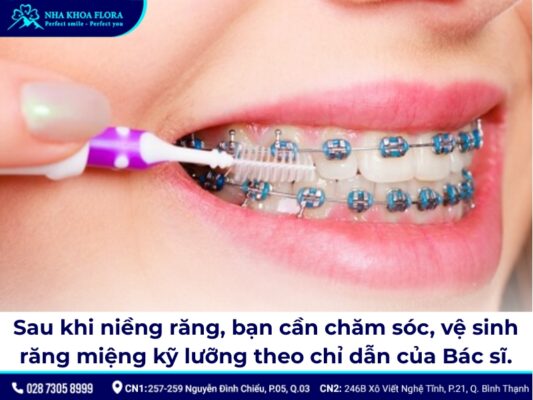 giai đoạn xấu nhất khi niềng răng - ảnh 3 giai đoạn xấu nhất khi niềng răng - ảnh 3