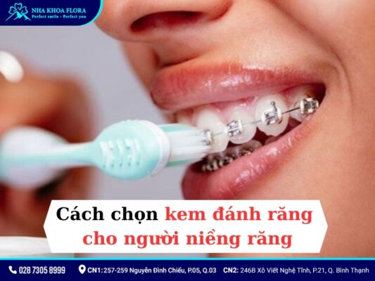 Kem đánh răng cho người niềng răng - ảnh 1