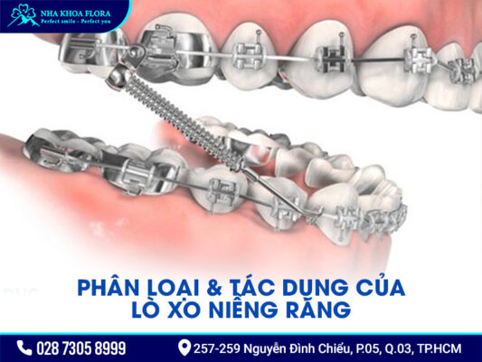 Lò xo niềng răng - ảnh 2