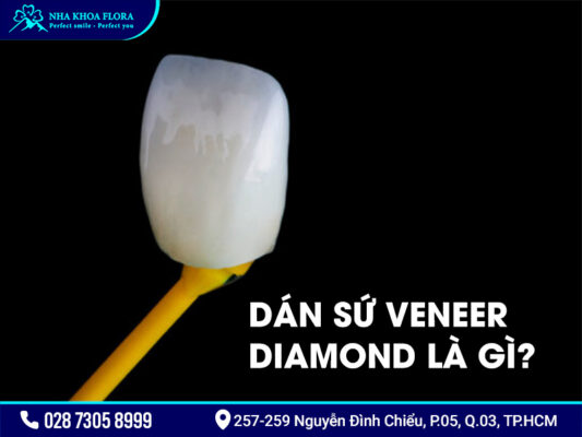 Mặt dán sứ Diamond - ảnh 1
