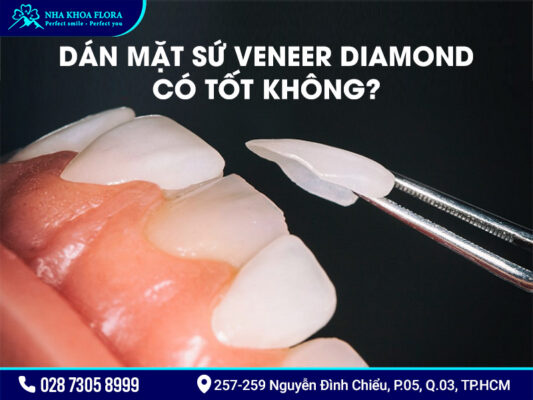 Mặt dán sứ Diamond - ảnh 2