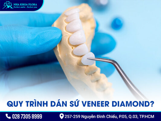Mặt dán sứ Diamond - ảnh 4