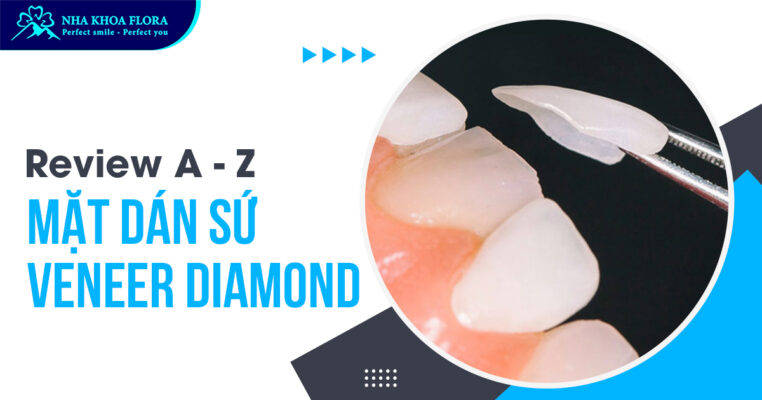 Mặt dán sứ Diamond