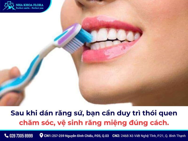 nhược điểm của dán răng sứ