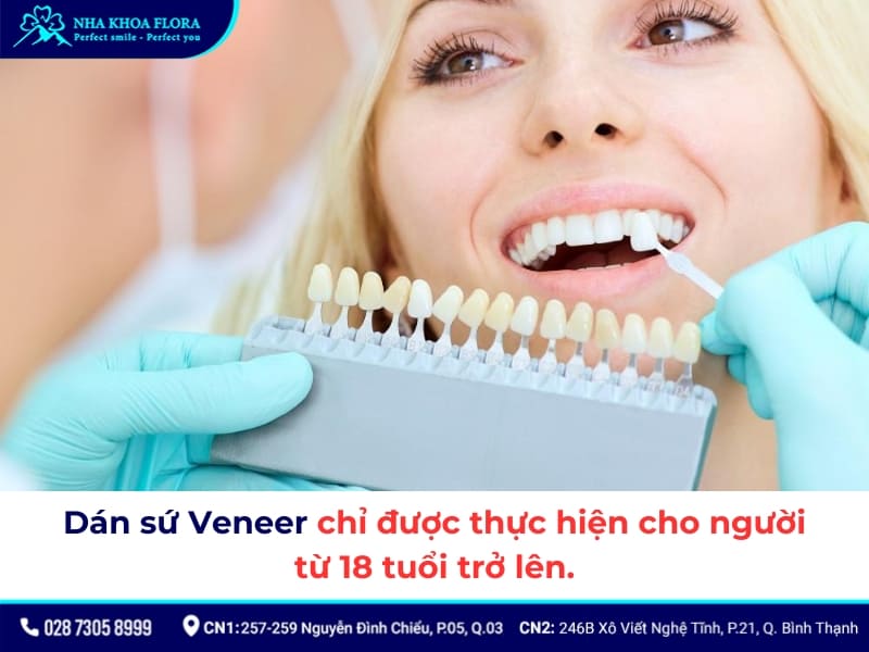 nhược điểm của dán răng sứ