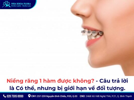 niềng răng 1 hàm - ảnh 1 niềng răng 1 hàm - ảnh 1