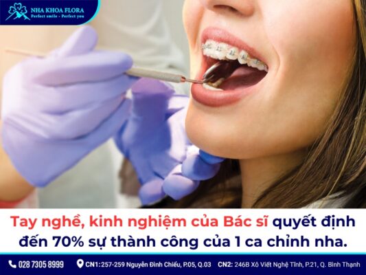 niềng răng 1 hàm - ảnh 4 niềng răng 1 hàm - ảnh 4