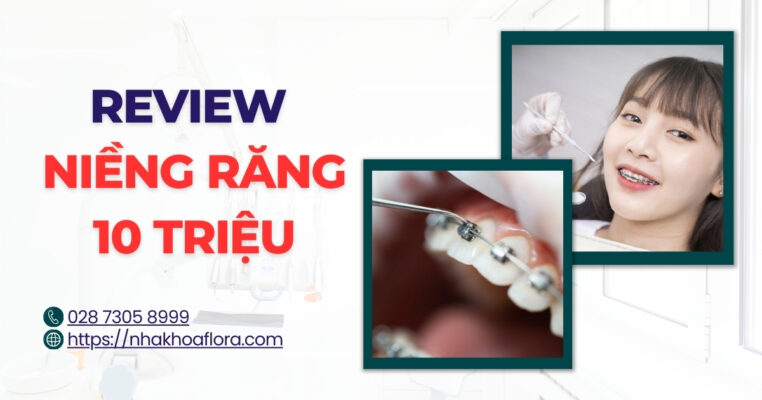 Niềng răng 10 triệu