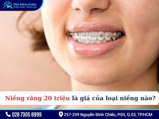 Niềng răng 20 triệu - ảnh 1