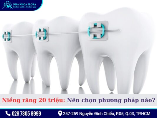 Niềng răng 20 triệu - ảnh 2