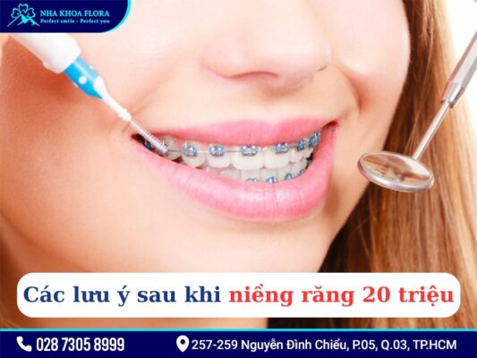Niềng răng 20 triệu - ảnh 4