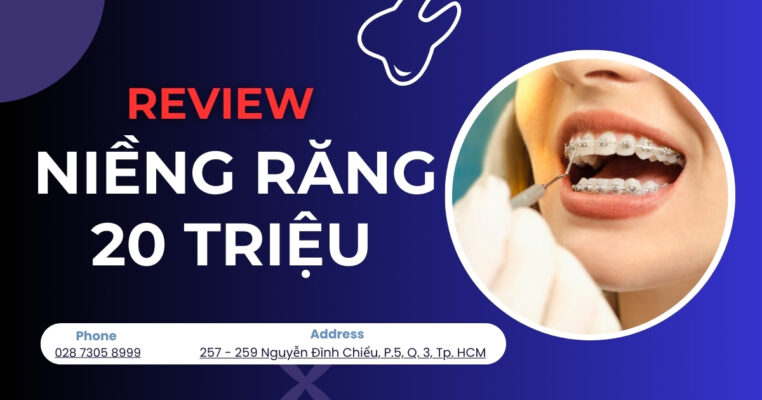 Niềng răng 20 triệu