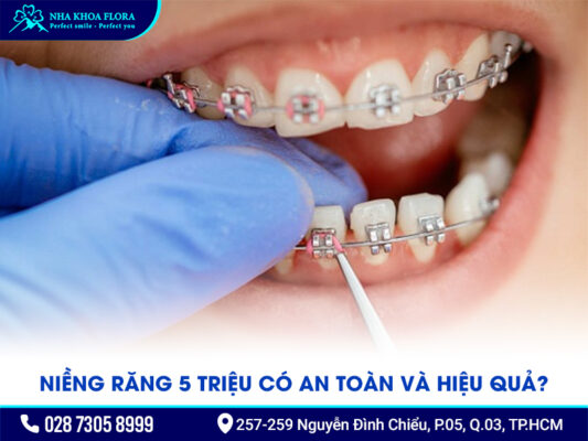 Niềng răng 5 triệu - ảnh 1