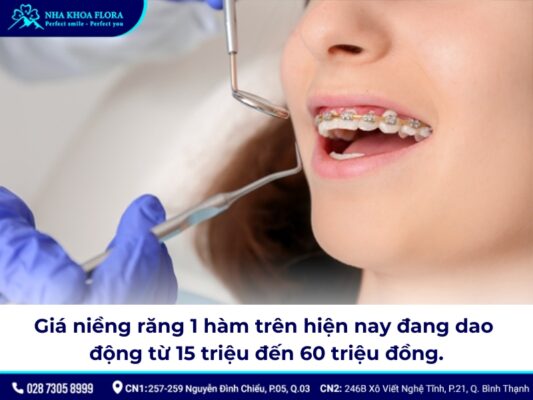 Niềng răng bao nhiêu tiền 1 hàm - ảnh 3