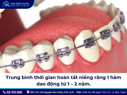 Niềng răng bao nhiêu tiền 1 hàm - ảnh 5