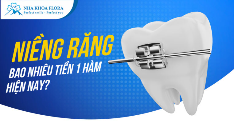 Niềng răng bao nhiêu tiền 1 hàm