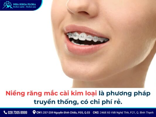 niềng răng cửa - ảnh 2