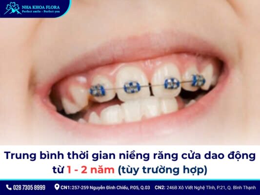 niềng răng cửa - ảnh 5