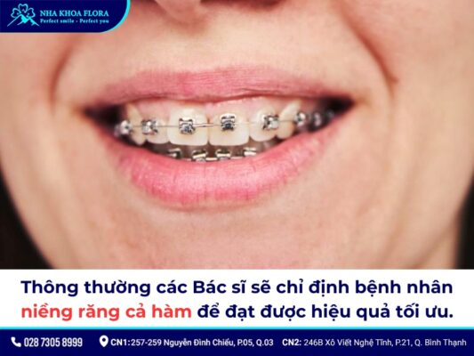 niềng răng cửa - ảnh 6