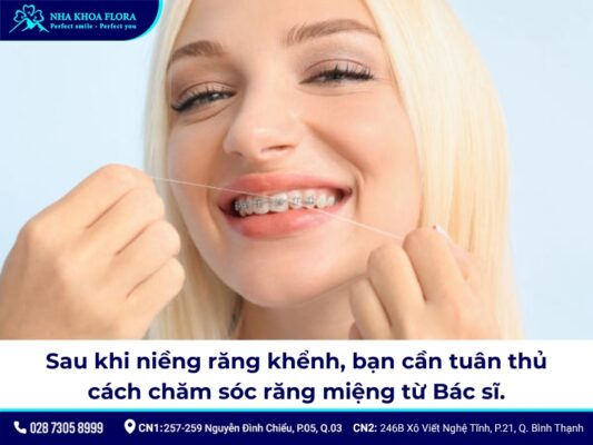 Niềng răng khểnh - ảnh 6