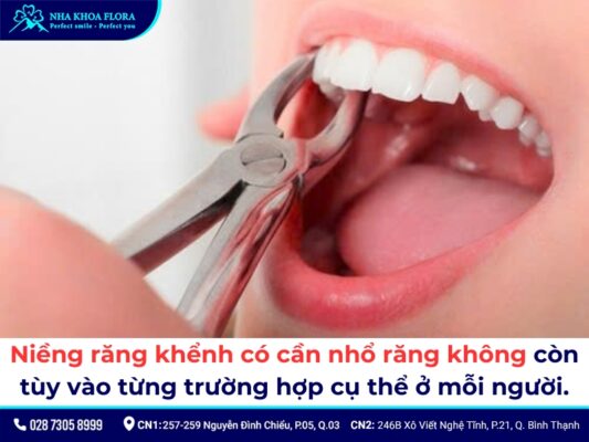 Niềng răng khểnh - ảnh 8