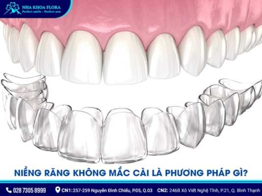 niềng răng không mắc cài - ảnh 1 niềng răng không mắc cài - ảnh 1