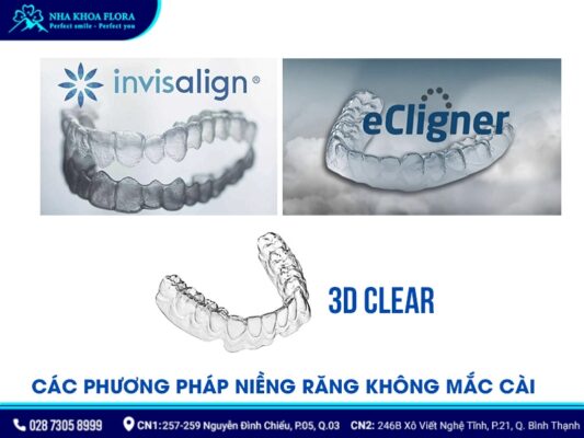 niềng răng không mắc cài - ảnh 3 niềng răng không mắc cài - ảnh 3