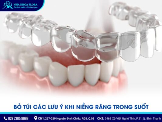 niềng răng không mắc cài - ảnh 4 niềng răng không mắc cài - ảnh 4