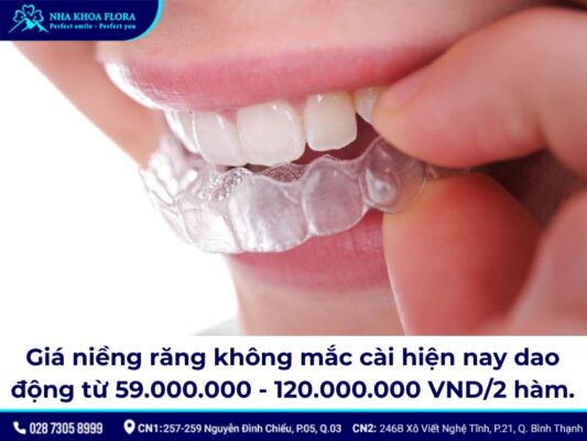niềng răng không mắc cài - ảnh 5 niềng răng không mắc cài - ảnh 5