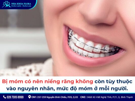 niềng răng móm - ảnh 3